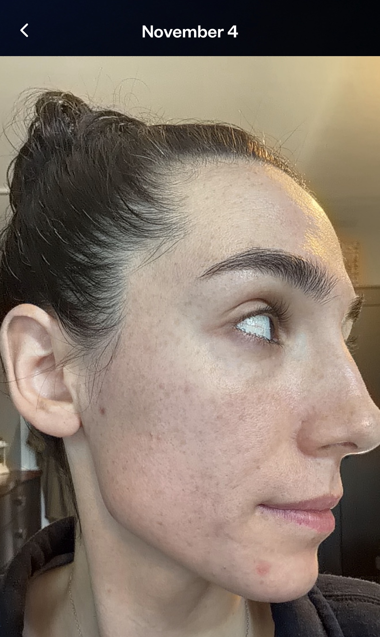 Real member skin photo from July 4